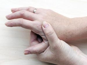 Нейродермит на пальцах рук, фото у взрослых
