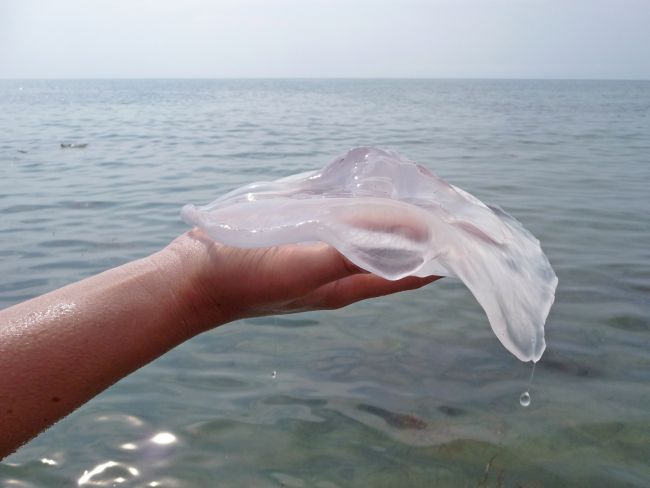 ожог руки медузой - фото