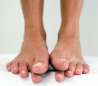 потница на ногах и ступнях у взрослых: диагностика и лечение