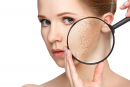 сухая кожа: причины и лечение