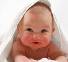Аллергия на щеках у ребенка симптомы thumbnail