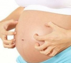 кожный зуд во время беременности