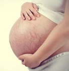почему возникают стрии у беременных? лучшие средства от растяжек при беременности