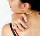 аллергия на коже: симптомы и лечение