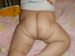 Авитаминоз у грудного ребенка, фото