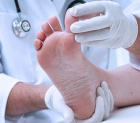 экзема на ногах: как предотвратить развитие болезни?