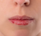 сухая кожа губ: причины и уход
